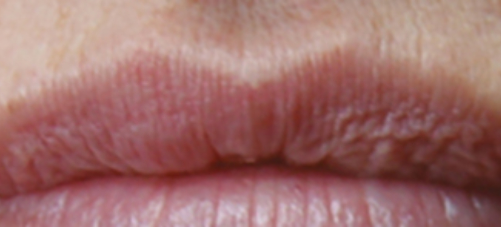 Dr christine may lips banner