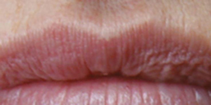 Dr christine may lips banner